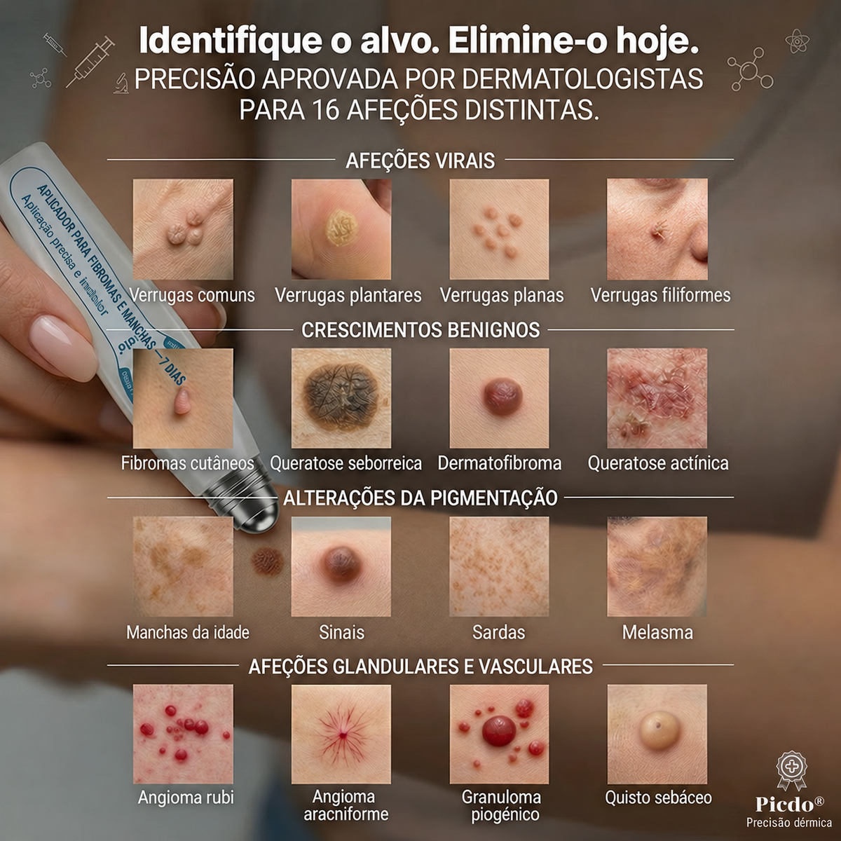 🧶🐍𝐏i𝐜𝐝o® Eliminador de Marcas e Manchas em 7 Dias (Roll-on Sem Dor e Sem Cicatrizes)