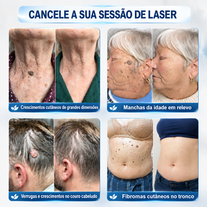 🧶🐍𝐏i𝐜𝐝o® Eliminador de Marcas e Manchas em 7 Dias (Roll-on Sem Dor e Sem Cicatrizes)